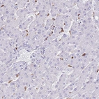Immunohistochemical staining of human liver shows moderate positivity in Kupffer cells.