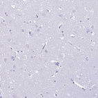 Immunohistochemical staining of human cerebral cortex shows no positivity as expected.