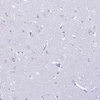 Immunohistochemical staining of human cerebral cortex shows no positivity as expected.