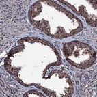 Anti-OGFOD2 Antibody