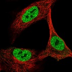 Immunofluorescent staining of human cell line A549 shows localization to nucleoplasm.