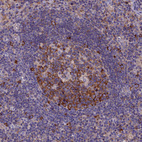 Immunohistochemical staining of human lymph node shows moderate cytoplasmic positivity in germinal center cells.