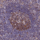 Immunohistochemical staining of human lymph node shows moderate cytoplasmic positivity in germinal center cells.