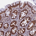 Immunohistochemical staining of human gastrointestinal shows strong cytoplasmic positivity in glandular cells.