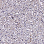 Immunohistochemical staining of human liver shows very weak cytoplasmic positivity in hepatocytes.