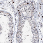 Anti-ABCG4 Antibody