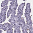 Immunohistochemical staining of human fallopian tube shows strong cytoplasmic positivity in cilia glandular cells.