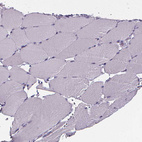 Immunohistochemical staining of human skeletal muscle shows no positivity in myocytes as expected.