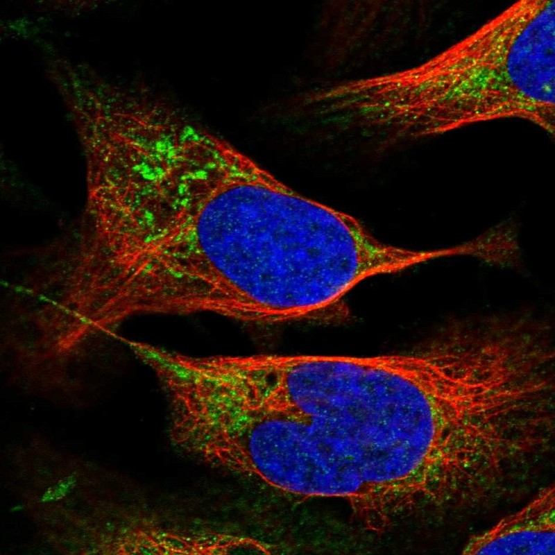 Anti-PTPMT1 Antibody