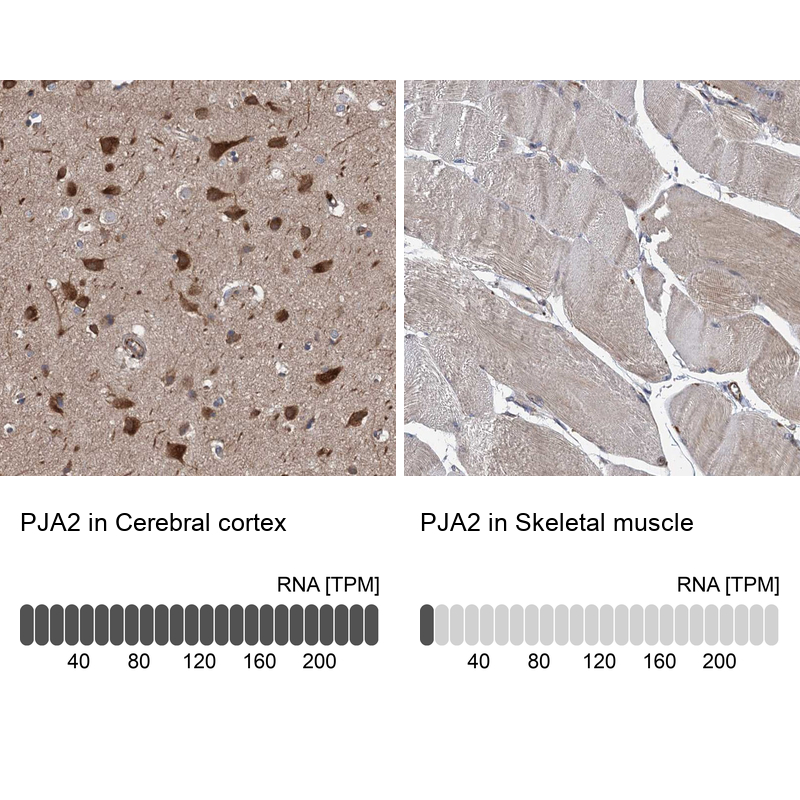 Anti-PJA2 Antibody