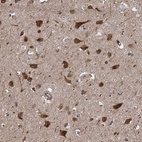 Immunohistochemical staining of human cerebral cortex shows high expression.