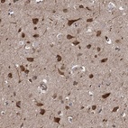 Anti-PJA2 Antibody