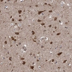 Immunohistochemical staining of human cerebral cortex shows high expression.