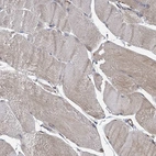 Immunohistochemical staining of human skeletal muscle shows low expression as expected.