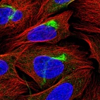 Immunofluorescent staining of human cell line U-2 OS shows localization to intermediate filaments.