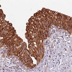 Anti-TIGAR Antibody