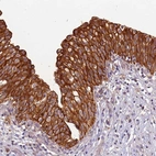 Anti-TIGAR Antibody