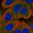 Immunofluorescent staining of human cell line MCF7 shows localization to cytosol.