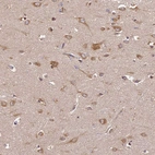 Immunohistochemical staining of human cerebral cortex shows moderate cytoplasmic positivity in neurons.