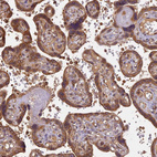 Immunohistochemical staining of human placenta shows strong cytoplasmic positivity in trophoblastic cells.