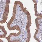 Immunohistochemical staining of human Fallopian tube shows moderate cytoplasmic positivity in glandular cells.
