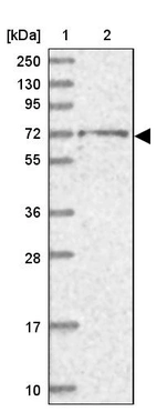 Lane 1: Marker [kDa] 250, 130, 95, 72, 55, 36, 28, 17, 10_br/_Lane 2: Human cell line RT-4