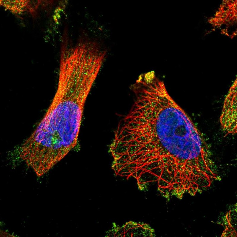 Anti-TUBGCP5 Antibody