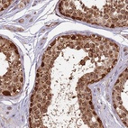 Anti-RAPGEF3 Antibody