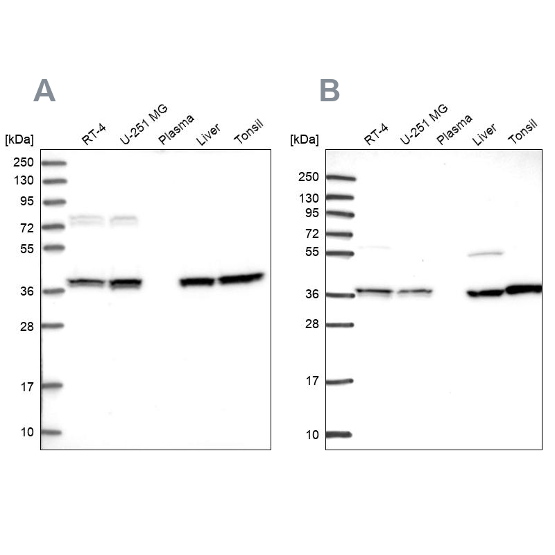 Anti-TALDO1 Antibody