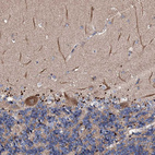 Anti-CKAP5 Antibody