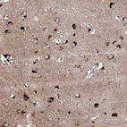 Immunohistochemical staining of human cerebral cortex shows strong cytoplasmic positivity in neurons.