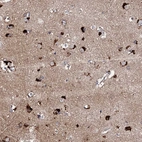 Immunohistochemical staining of human cerebral cortex shows strong cytoplasmic positivity in neurons.