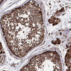 Immunohistochemical staining of human testis shows strong cytoplasmic positivity in cells in seminiferous ducts.