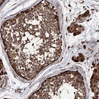 Immunohistochemical staining of human testis shows strong cytoplasmic positivity in cells in seminiferous ducts.