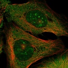 Immunofluorescent staining of human cell line U-2 OS shows localization to nucleoli, plasma membrane & centrosome.