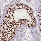 Anti-ZNF662 Antibody