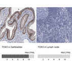 Anti-TOX3 Antibody