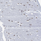 Immunohistochemical staining of human Cerebral cortex shows moderate nuclear positivity in neuronal cells.