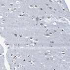 Immunohistochemical staining of human Cerebral cortex shows moderate nuclear positivity in neuronal cells.