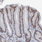 Anti-TOX3 Antibody