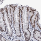 Immunohistochemical staining of human Stomach shows moderate nuclear positivity in glandular cells.
