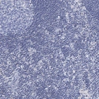 Immunohistochemical staining of human Lymph node shows no positivity in non-germinal center cells as expected.
