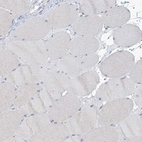 Immunohistochemical staining of human Skeletal muscle shows no positivity in myocytes as expected.