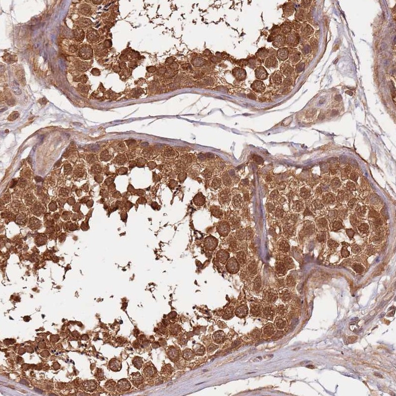Anti-UBE3A Antibody
