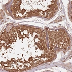 Anti-UBE3A Antibody