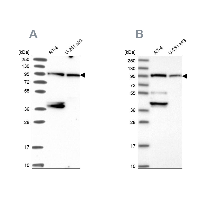 Rabbit Polyclonal AntiUBE3A Antibody Buy for research Highly