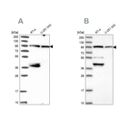 Western blot analysis using Anti-UBE3A antibody HPA040380 (A) shows similar pattern to independent antibody HPA039410 (B).