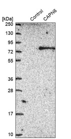 Anti-CAPN6 Antibody