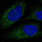 Immunofluorescent staining of human cell line U-2 OS shows localization to cytosol.