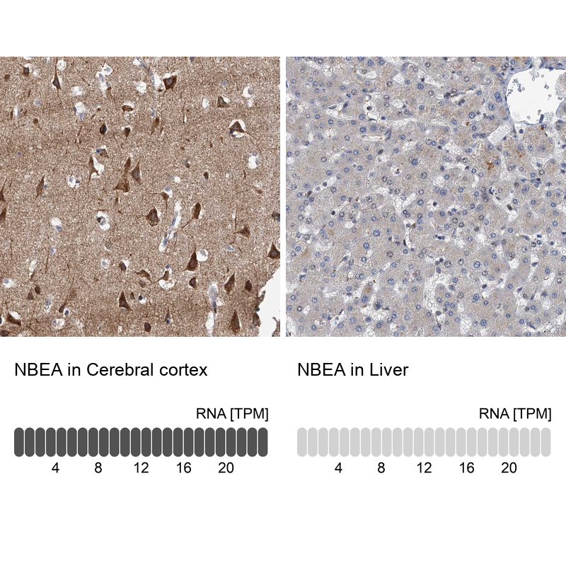 Anti-NBEA Antibody